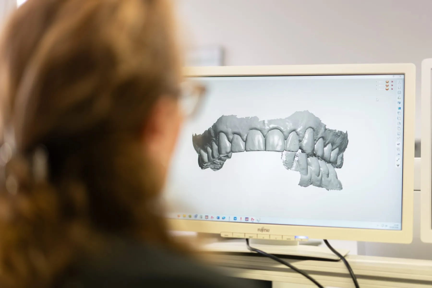 Digitaler Kieferscan am Bildschirm im Resilab